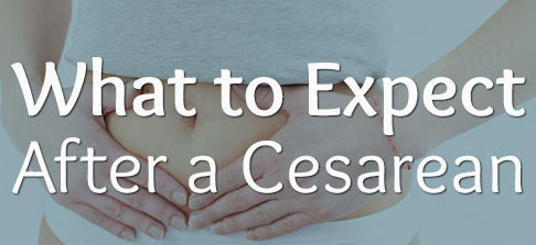 what to expect after a c section